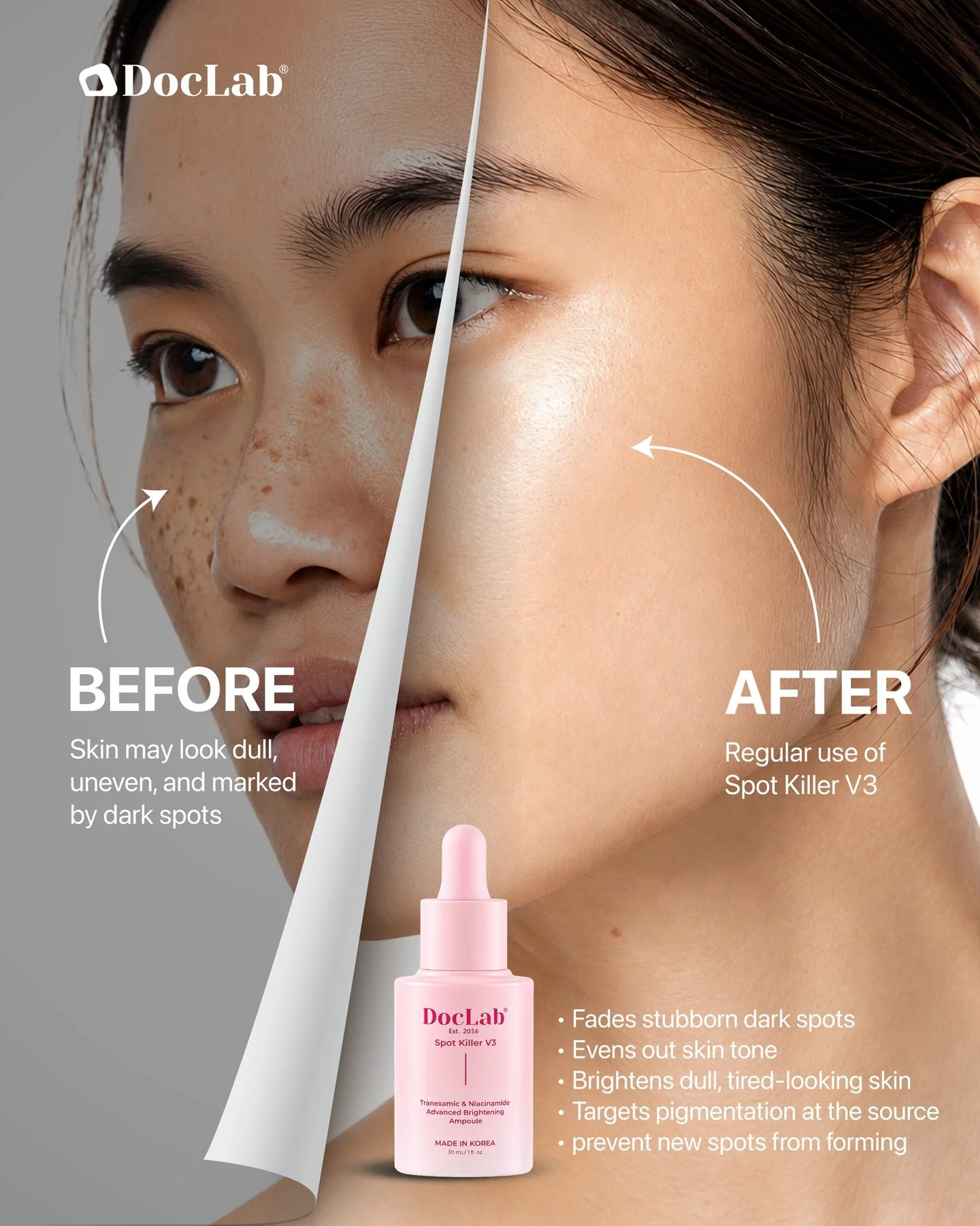 Before: skin may look dull, uneven and marked by dark spots. After: regular use of Spot Killer V3. Fades stubborn dark spots, evens out skin tone, brightens dull, tired-looking skin, targets pigmentation at the source, prevents new spots from forming.