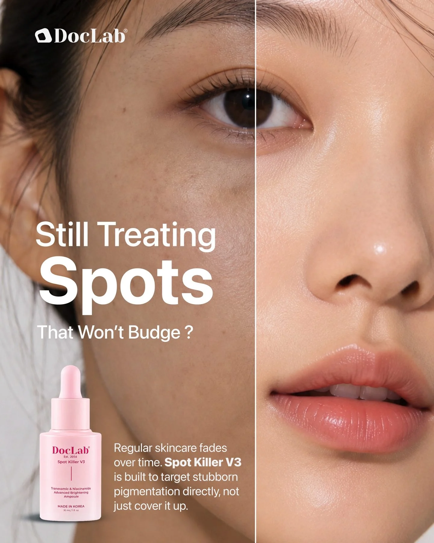 Still treating spots that won't budge? Regular skincare fades over time. Spot Killer V3 is built to target stubborn pigmentation directly, not just cover it up.